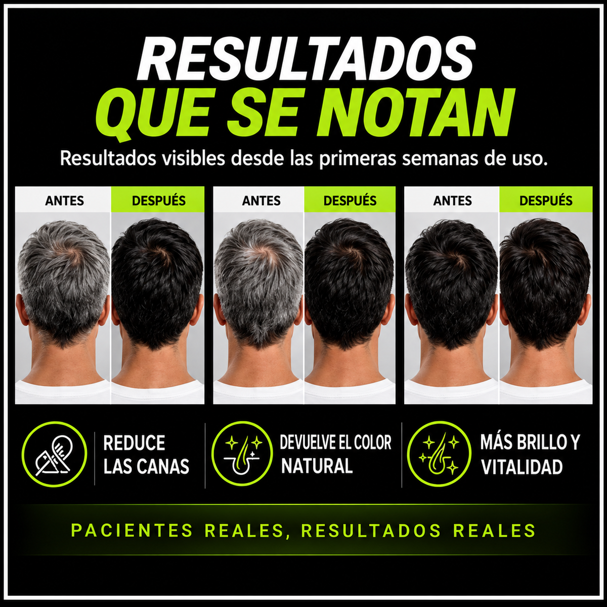 ZERO CANAS | CABELLO VISIBLEMENTE MÁS OSCURO EN 7 DÍAS